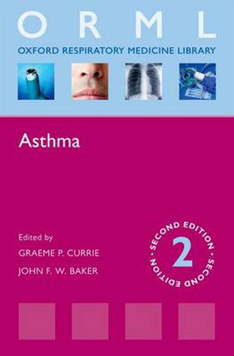 Cover image for Asthma