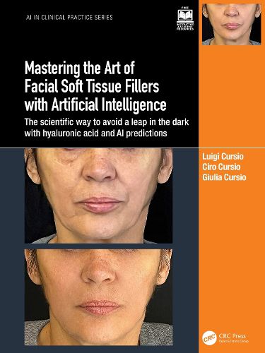 Cover image for Mastering the Art of Facial Soft Tissue Fillers with Artificial Intelligence