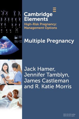 Cover image for Multiple Pregnancy