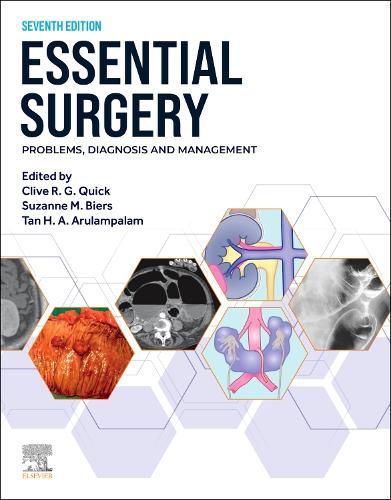 Cover image for Essential Surgery