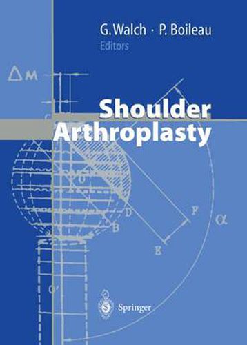 Cover image for Shoulder Arthroplasty