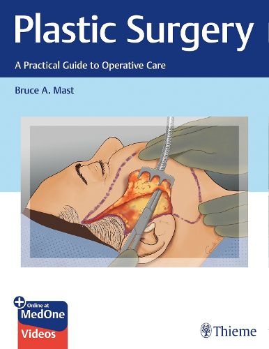 Cover image for Plastic Surgery: A Practical Guide to Operative Care