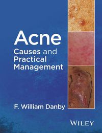 Cover image for Acne: Causes and Practical Management