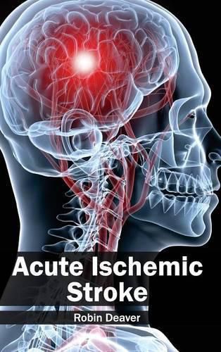 Cover image for Acute Ischemic Stroke