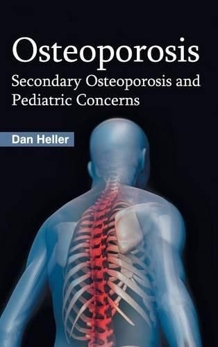 Cover image for Osteoporosis: Secondary Osteoporosis and Pediatric Concerns