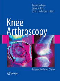 Cover image for Knee Arthroscopy