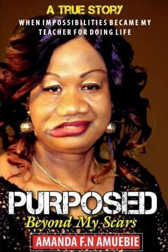 Cover image for Purposed Beyond My Scars: When impossibilities Became My Teacher For Doing Life