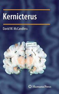 Cover image for Kernicterus