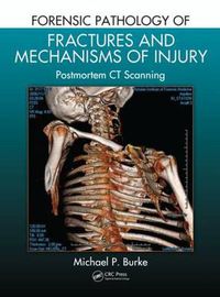 Cover image for Forensic Pathology of Fractures and Mechanisms of Injury: Postmortem CT Scanning