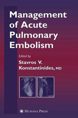 Cover image for Management of Acute Pulmonary Embolism