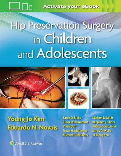 Cover image for Hip Preservation Surgery in Children and Adolescents