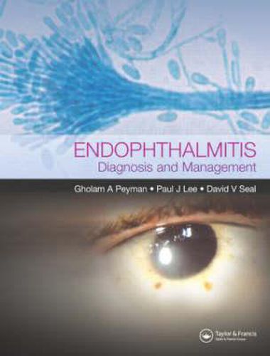 Cover image for Endophthalmitis: Diagnosis and Treatment