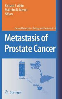 Cover image for Metastasis of Prostate Cancer