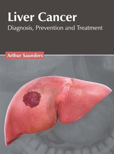 Cover image for Liver Cancer: Diagnosis, Prevention and Treatment