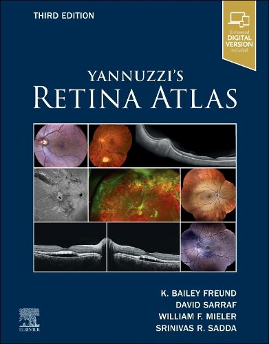 Cover image for Yannuzzi's Retina Atlas