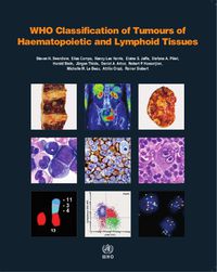 Cover image for WHO classification of tumours of haematopoietic and lymphoid tissues: Vol. 2