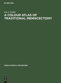 Cover image for A Colour Atlas of Traditional Meniscectomy