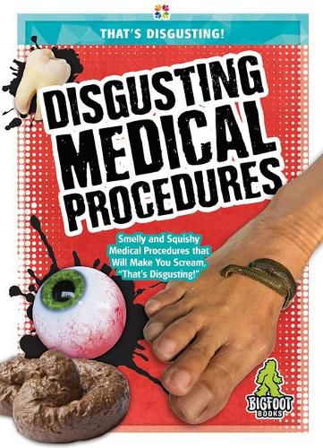 Disgusting Medical Procedures