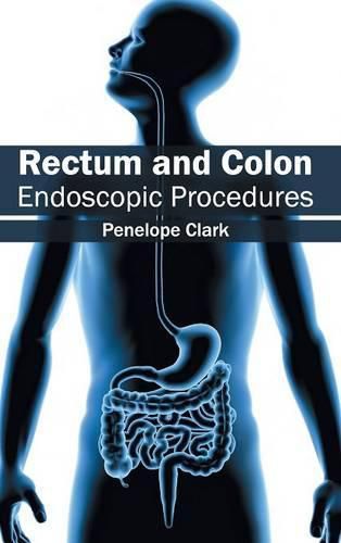 Cover image for Rectum and Colon: Endoscopic Procedures