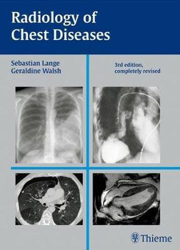 Cover image for Radiology of Chest Diseases