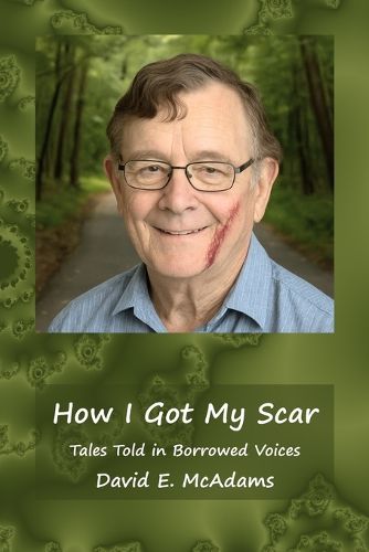 Cover image for How I Got My Scar