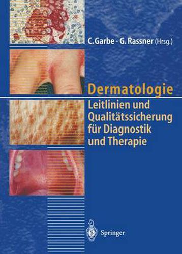 Cover image for Dermatologie: Leitlinien und Qualitatssicherung fur Diagnostik und Therapie Berichte von der 39. Tagung der Deutschen Dermatologischen Gesellschaft