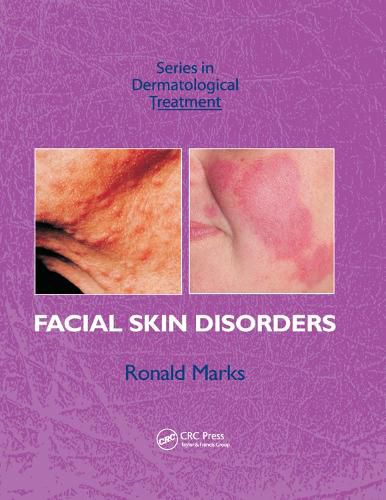 Cover image for Facial Skin Disorders