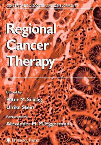 Regional Cancer Therapy