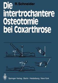 Cover image for Die intertrochantere Osteotomie bei Coxarthrose