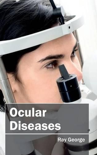 Cover image for Ocular Diseases