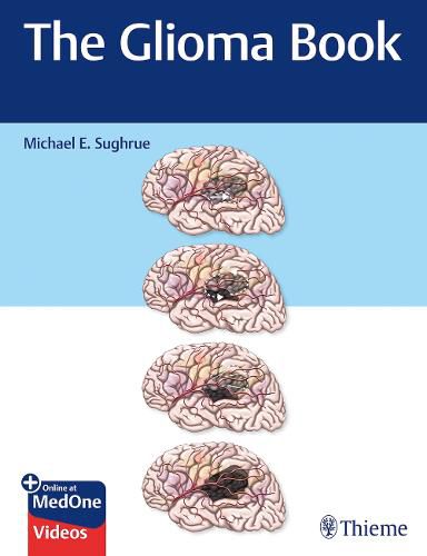 Cover image for The Glioma Book