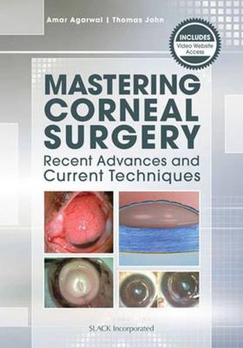 Cover image for Mastering Corneal Surgery: Recent Advances and Current Techniques