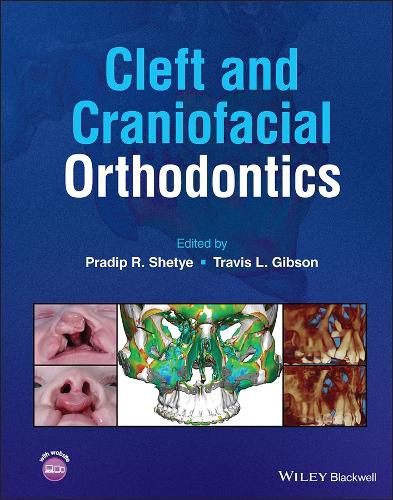 Cover image for Cleft and Craniofacial Orthodontics