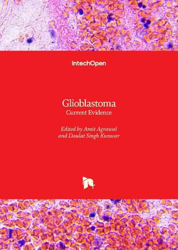 Cover image for Glioblastoma