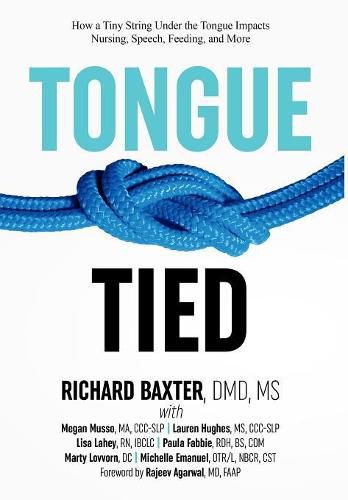 Tongue-Tied: How a Tiny String Under the Tongue Impacts Nursing, Speech, Feeding, and More