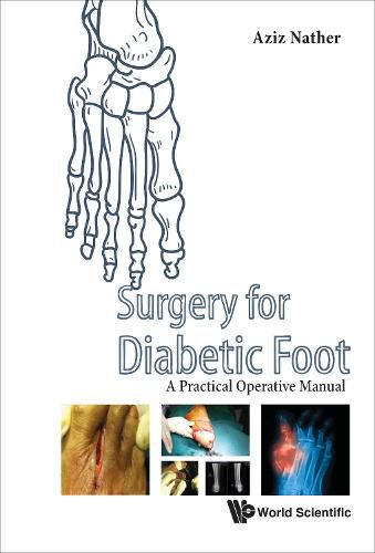 Cover image for Surgery For Diabetic Foot: A Practical Operative Manual