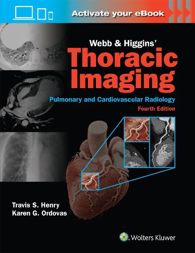 Webb & Higgins Thoracic Imaging: Print + eBook with Multimedia