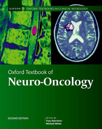 Cover image for Oxford Textbook of Neuro-Oncology