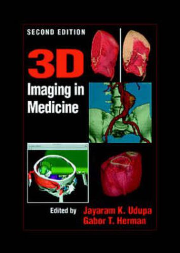 Cover image for 3D Imaging in Medicine, Second Edition