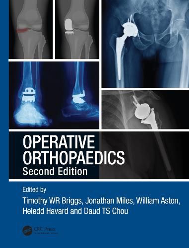 Cover image for Operative Orthopaedics: The Stanmore Guide