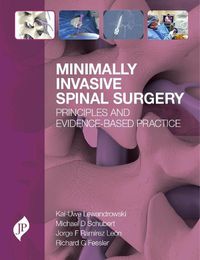 Cover image for Minimally Invasive Spinal Surgery: Principles and Evidence-Based Practice