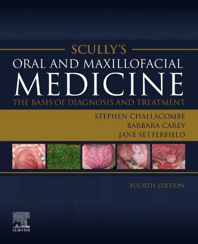 Oral and Maxillofacial Medicine: the Basis of Diagnosis and Treatment