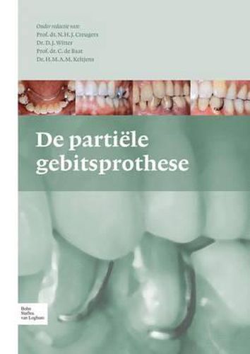 Cover image for de Partiele Gebitsprothese: Uitgangspunten Bij de Diagnostiek En Behandeling Van Het Gemutileerde Gebit