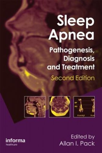 Cover image for Sleep Apnea: Pathogenesis, Diagnosis and Treatment