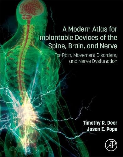 Cover image for A Modern Atlas for Implantable Devices of the Spine, Brain, and Nerve