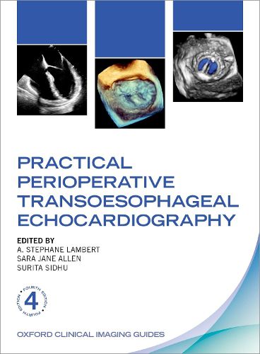 Cover image for Practical Perioperative Transoesophageal Echocardiography