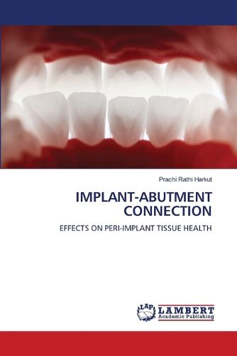 Cover image for Implant-Abutment Connection