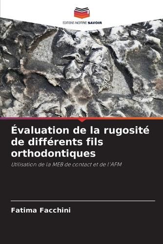 Cover image for Evaluation de la rugosite de differents fils orthodontiques