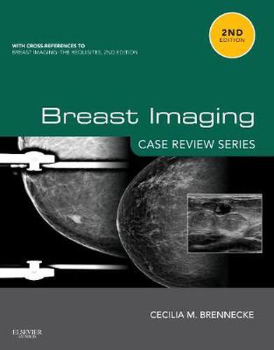 Cover image for Breast Imaging: Case Review Series