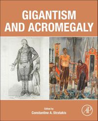 Cover image for Gigantism and Acromegaly